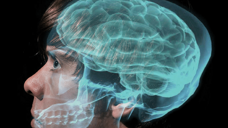 Rewriting the Script–How to Change your Brain