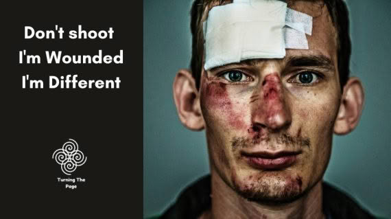 Don't shoot. I'm wounded. I'm different