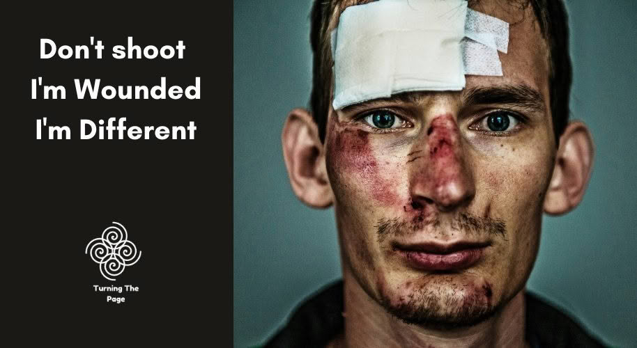 Don't shoot. I'm wounded. I'm different